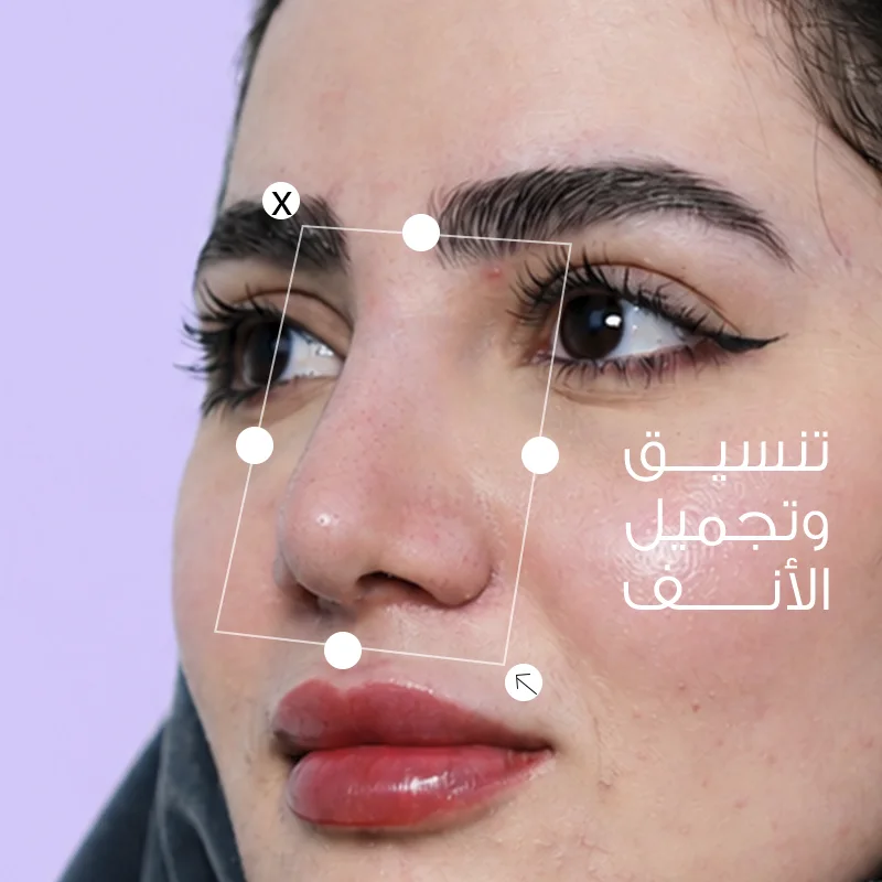 تجميل الأنف: كيف تعرفين أن النتيجة ستناسب ملامح وجهك؟
