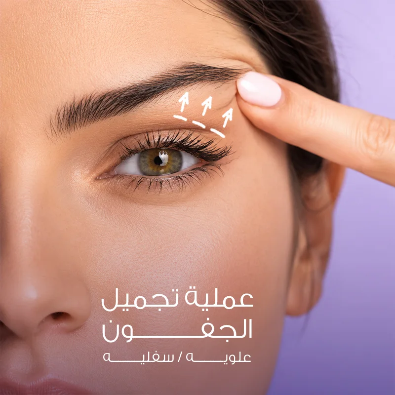 عملية تجميل الجفون علوي / سفلي