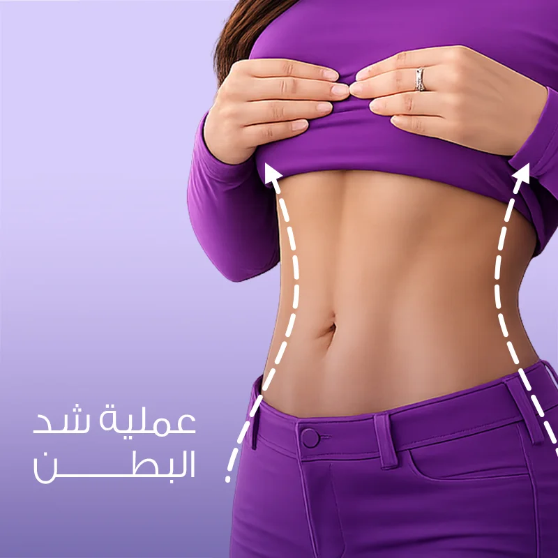 عملية شد البطن