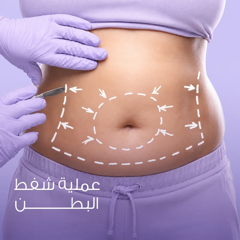 عمليات شفط الدهون