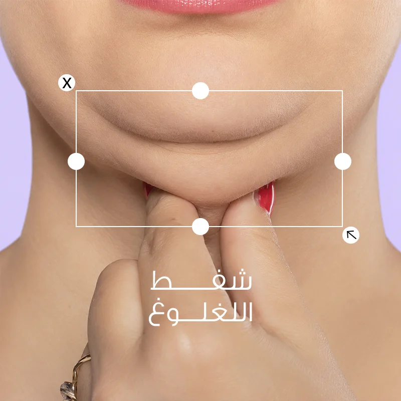شفط اللغلوغ