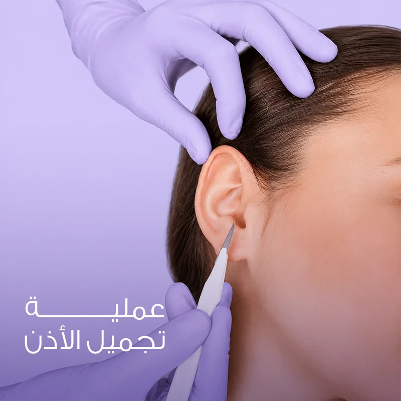 عملية تجميل الأذن